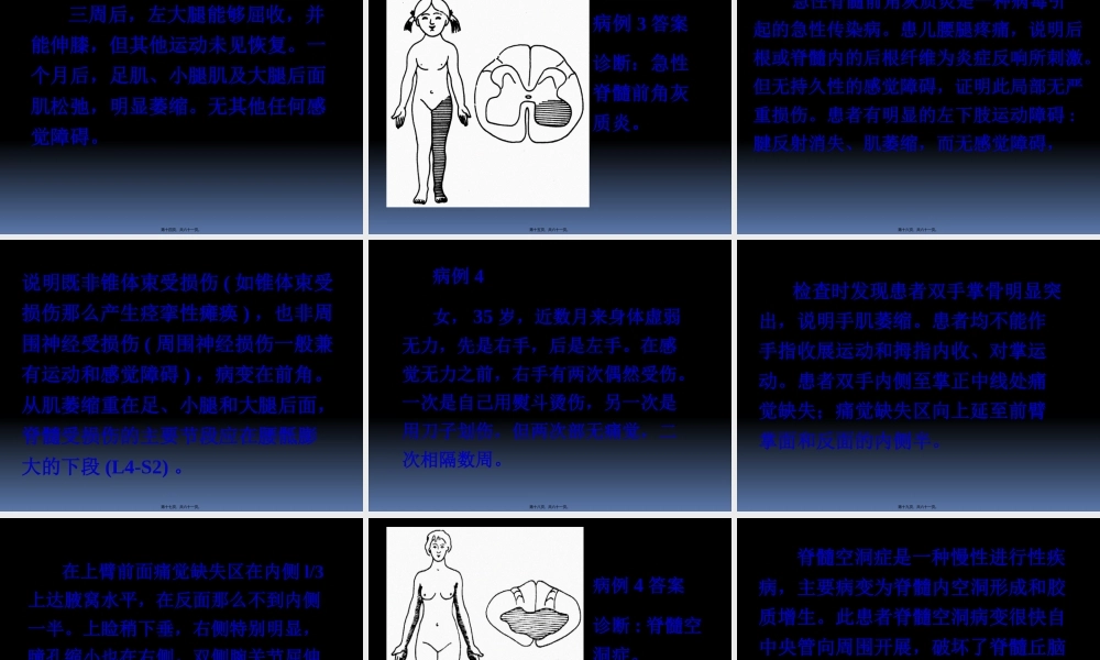 传导路病例讨论简述.pptx