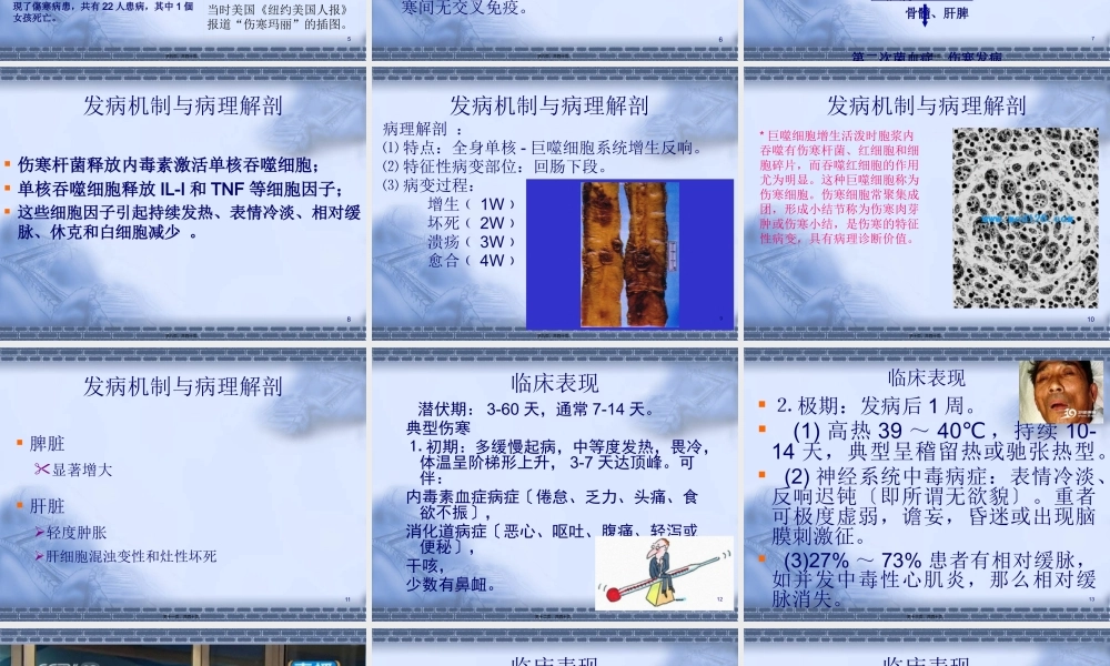 伤寒与副伤寒.pptx