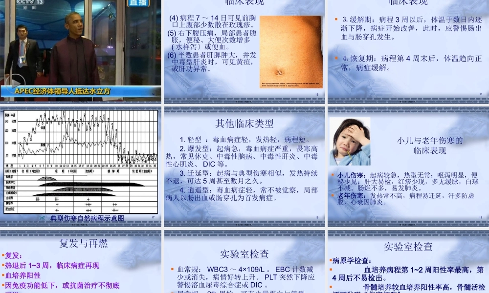 伤寒与副伤寒.pptx