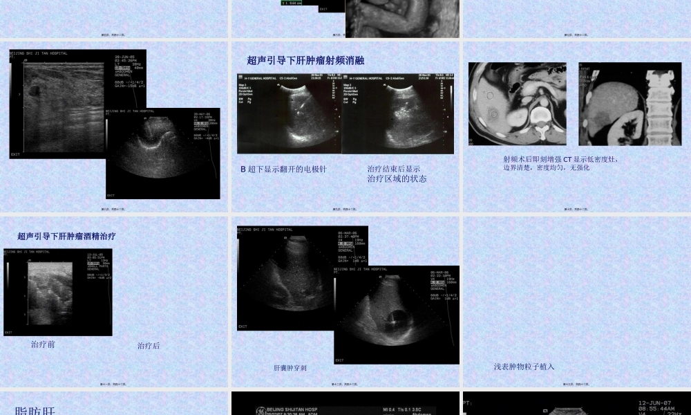 住院医师规培结业-腹部超声判读.pptx