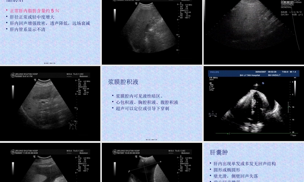 住院医师规培结业-腹部超声判读.pptx