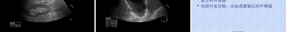 住院医师规培结业-腹部超声判读.pptx