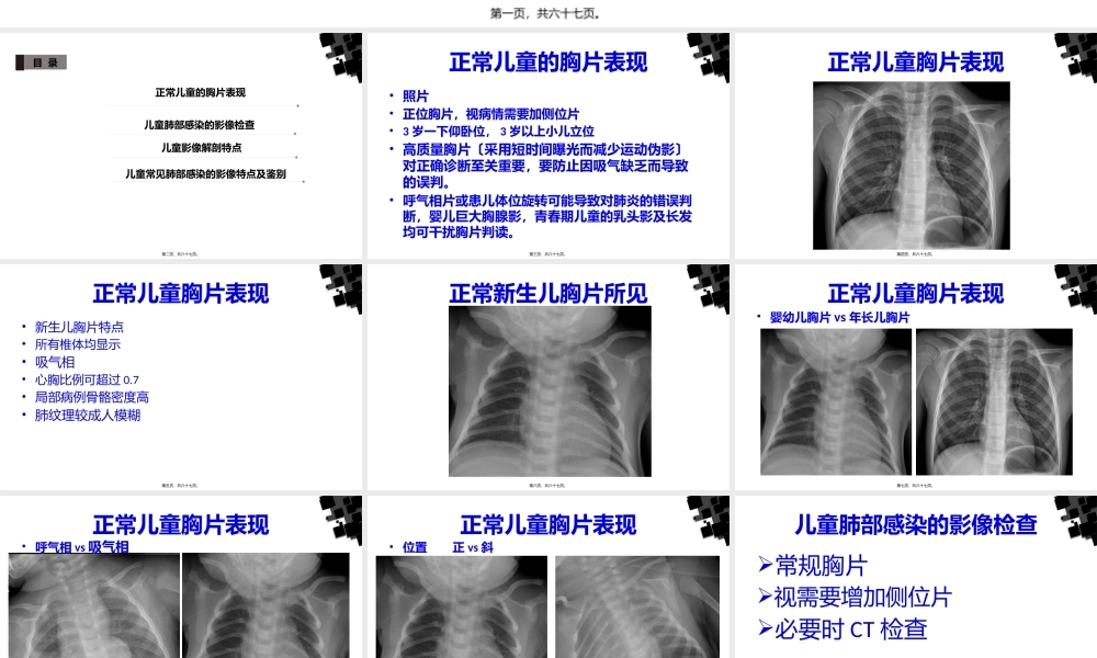 儿童常见肺部感染.pptx