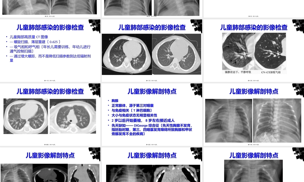 儿童常见肺部感染.pptx