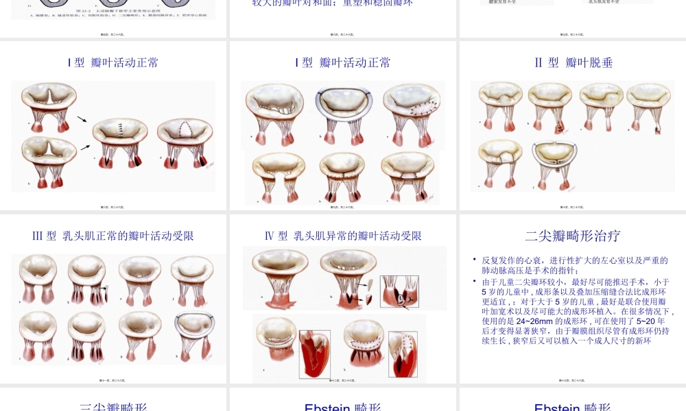 先天性心脏瓣膜病.pptx