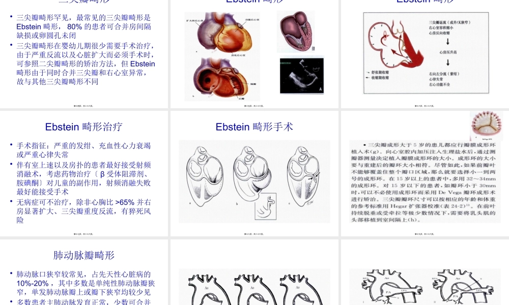 先天性心脏瓣膜病.pptx