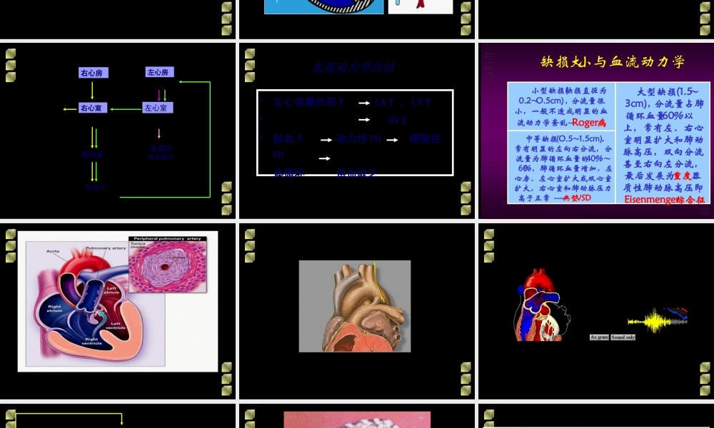 先天性心脏病血液动力学改变.pptx