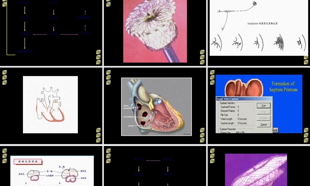 先天性心脏病血液动力学改变.pptx
