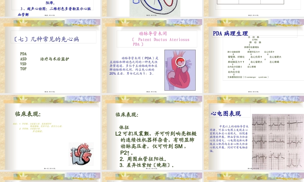 先天性心脏病模板.pptx