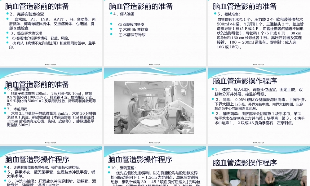 全脑血管造影技术-(1).pptx
