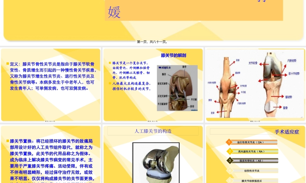 全膝关节置换术后康复.pptx