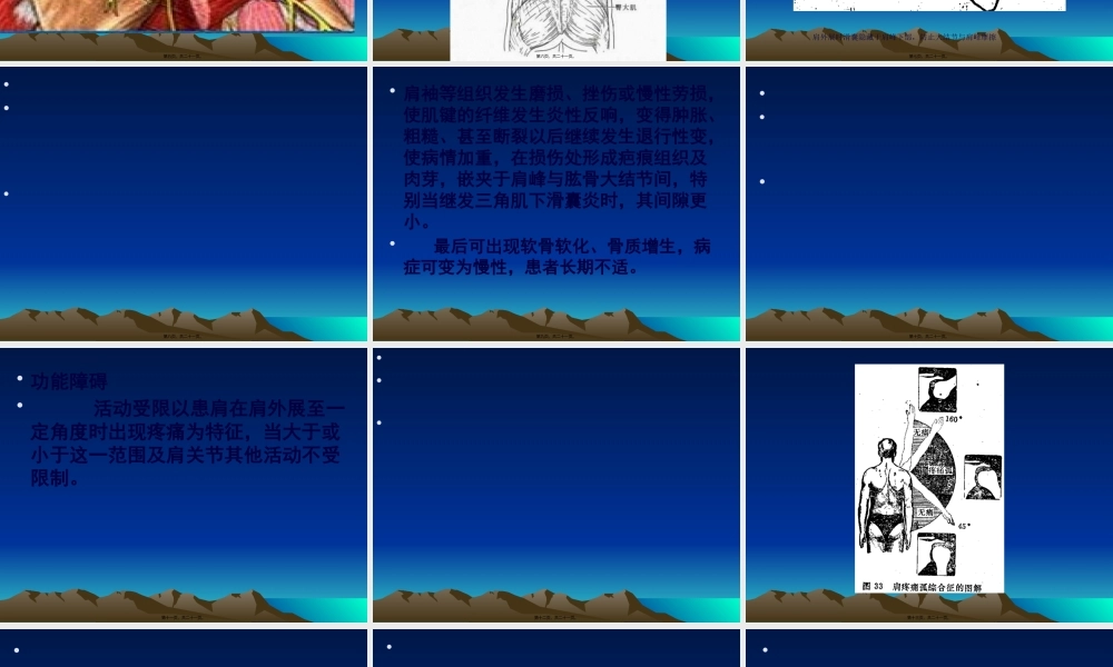 冈上肌肌腱炎.pptx