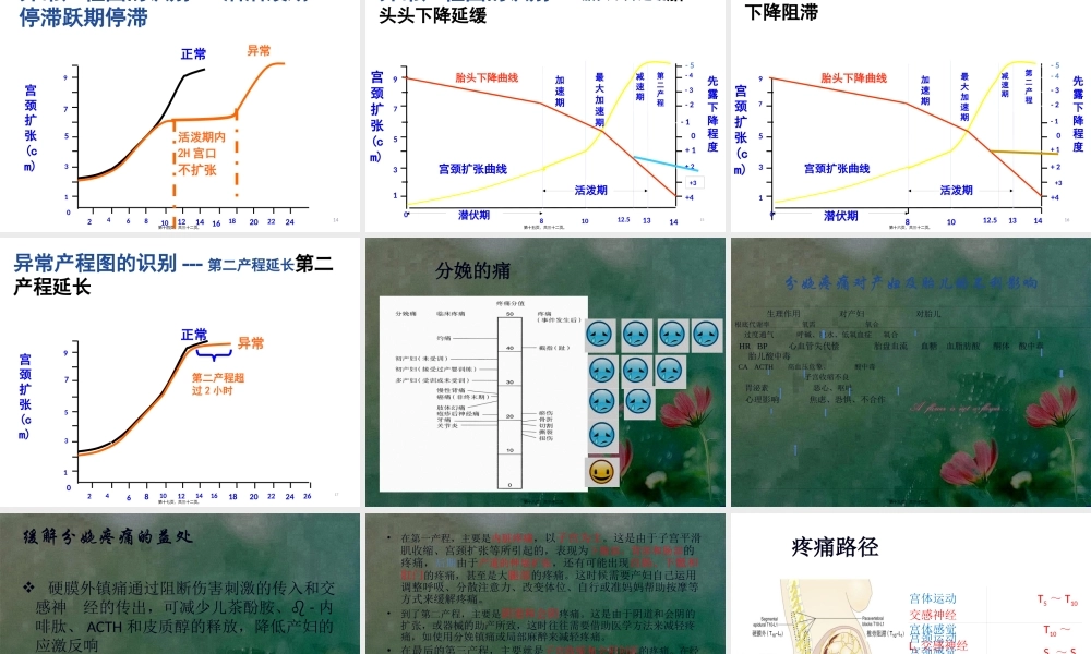 分娩疼痛的机制.pptx