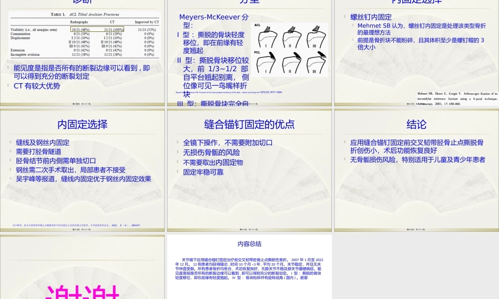 前交叉韧带胫骨止点撕脱性骨折.pptx