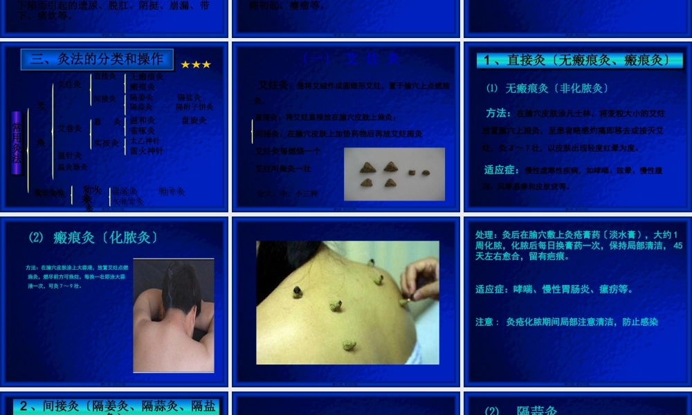 刺灸法-灸法、拔罐法.pptx