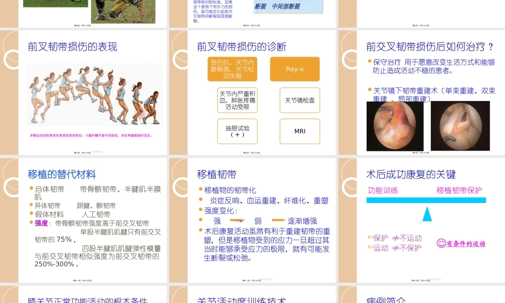 前叉韧带损伤的教学查房.pptx