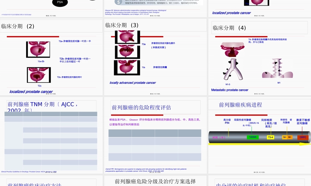 前列腺癌的诊治新进展.pptx