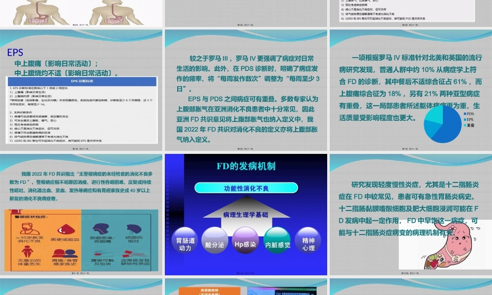 功能性消化不良诊治(修).ppt