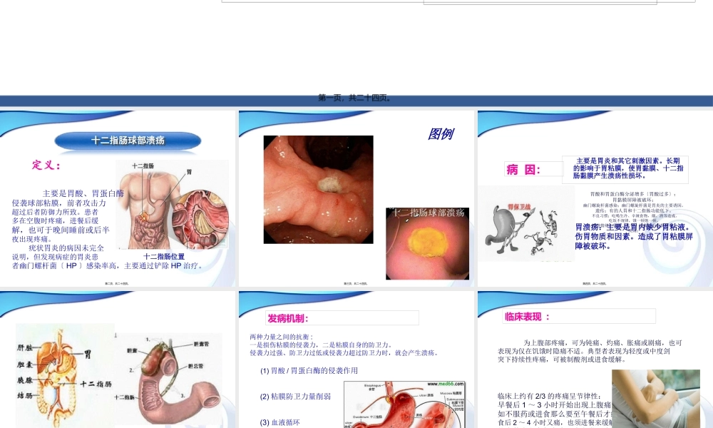十二指肠球部溃疡.pptx