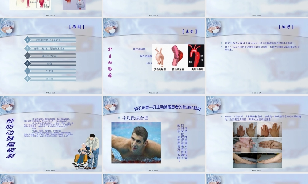 升主动脉瘤PPT.pptx