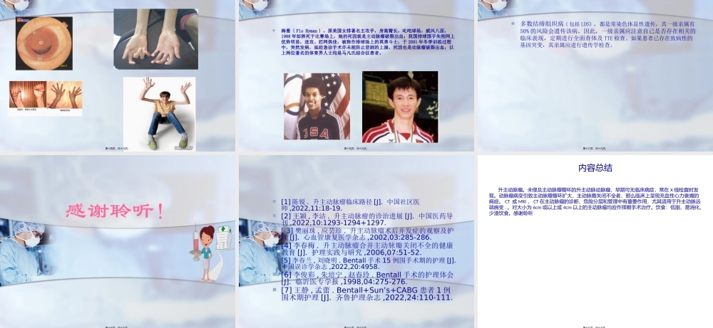 升主动脉瘤PPT.pptx