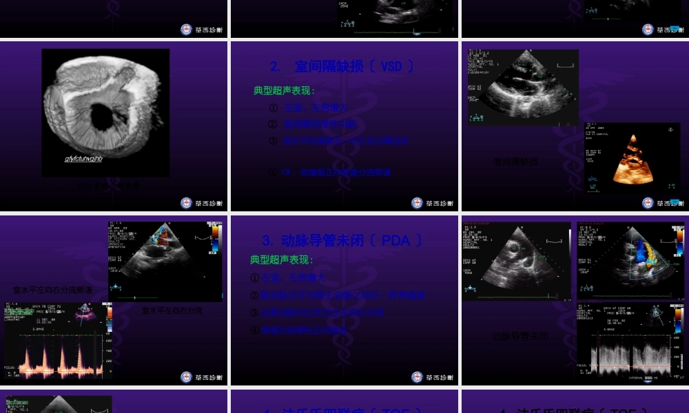 华西医科大精品课程-超声心动图3-异常.pptx