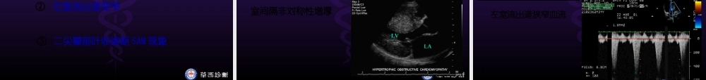 华西医科大精品课程-超声心动图3-异常.pptx