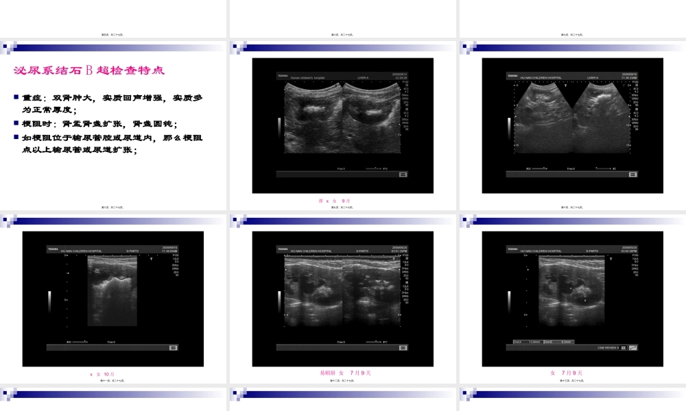 卫生部医政司关于婴幼儿奶粉一线救治工作经验研讨会(关于超声..pptx