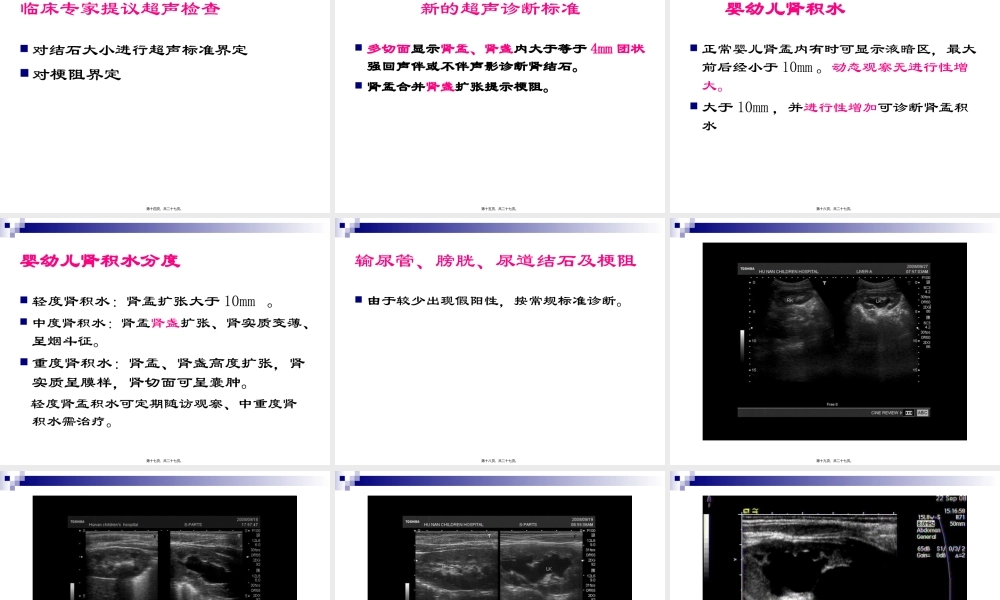 卫生部医政司关于婴幼儿奶粉一线救治工作经验研讨会(关于超声..pptx