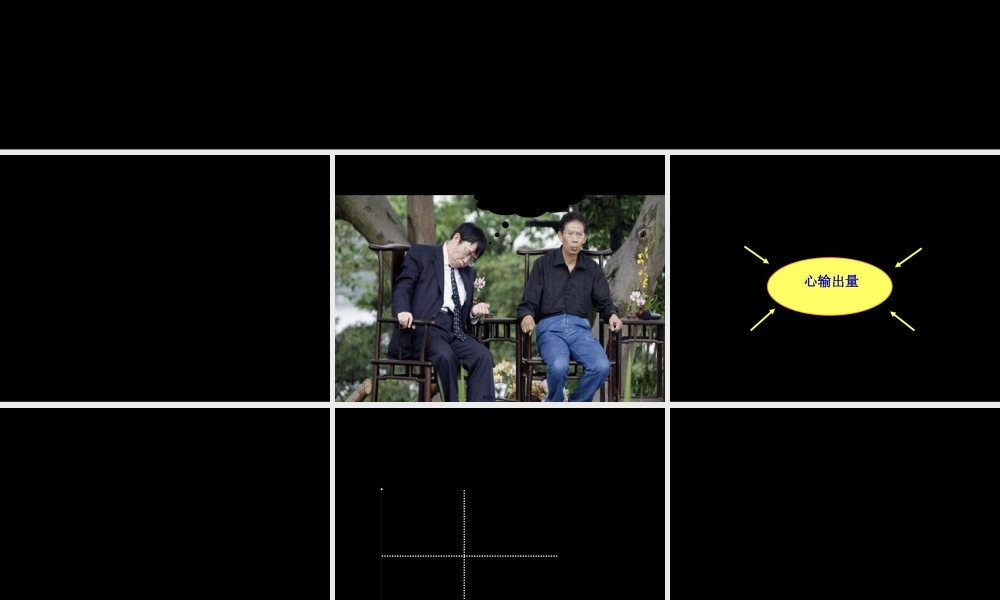 危重患者的血流动力学监测-协和.pptx