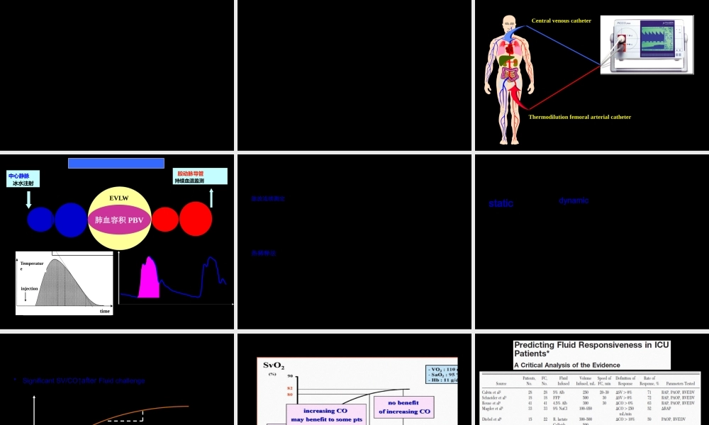 危重患者的血流动力学监测-协和.pptx