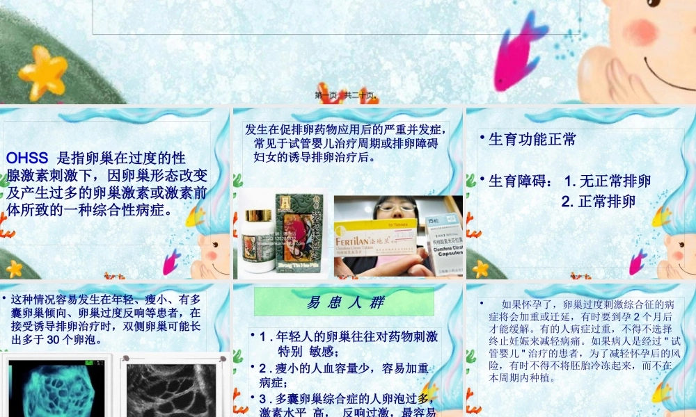 卵巢过度刺激综合症.pptx