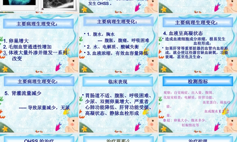 卵巢过度刺激综合症.pptx