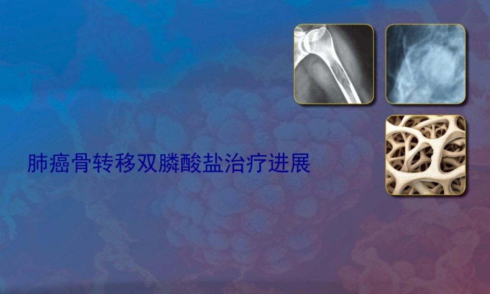 双膦酸盐在肺癌中骨转移的进展.pptx