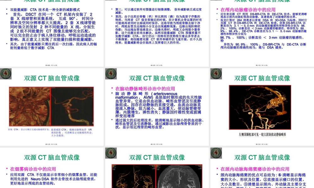 双源CT脑血管成像.pptx