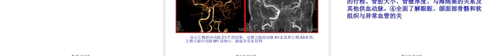 双源CT脑血管成像.pptx