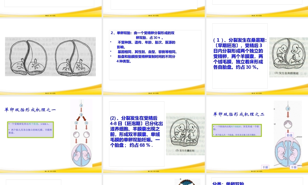 双胎妊娠与巨大胎儿-精选文档.pptx