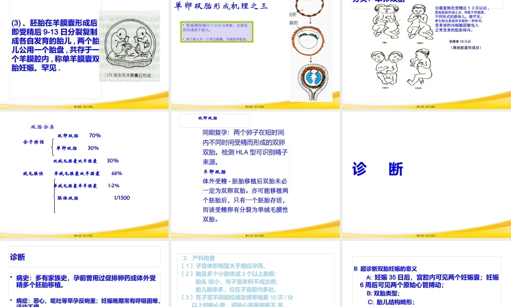 双胎妊娠与巨大胎儿-精选文档.pptx