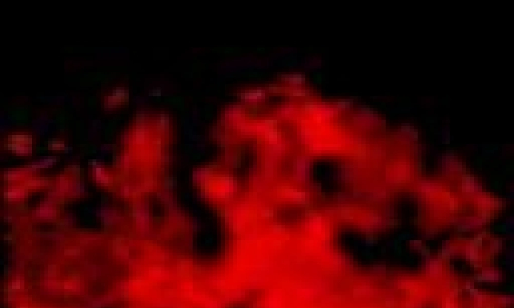 发热2011年4月7日.pptx