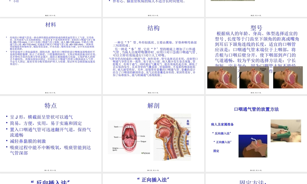 口咽通气管.pptx