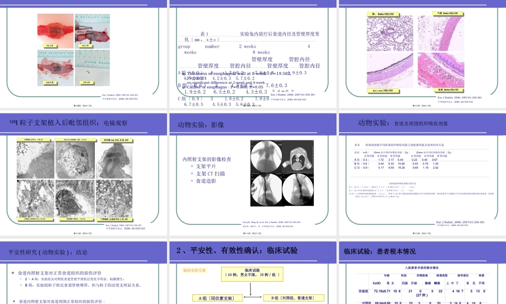 可携带放射粒子食道支架.pptx