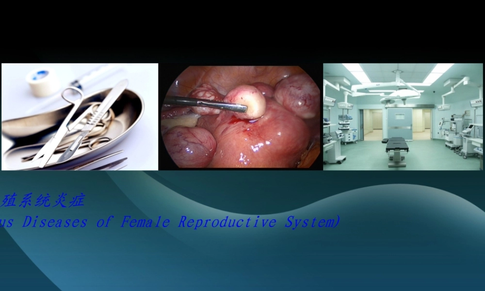各种阴道炎.pptx