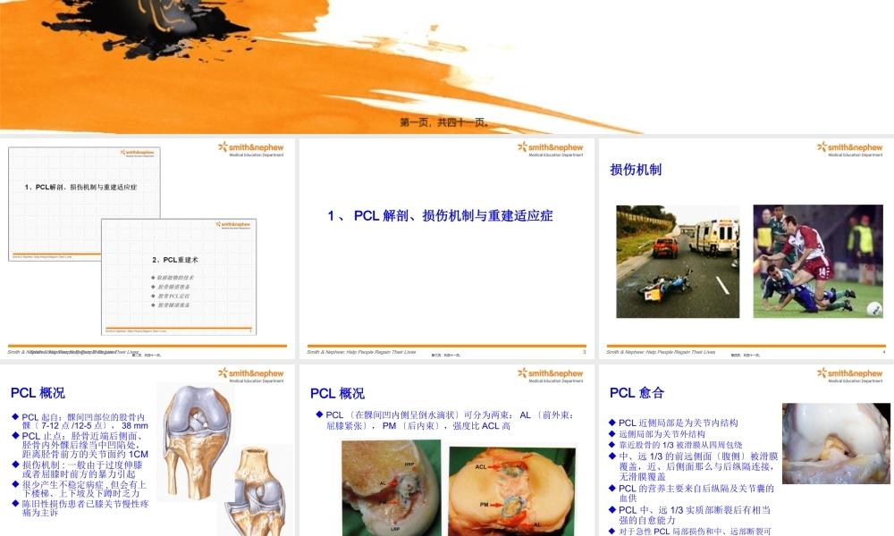 后交叉韧带重建术.pptx