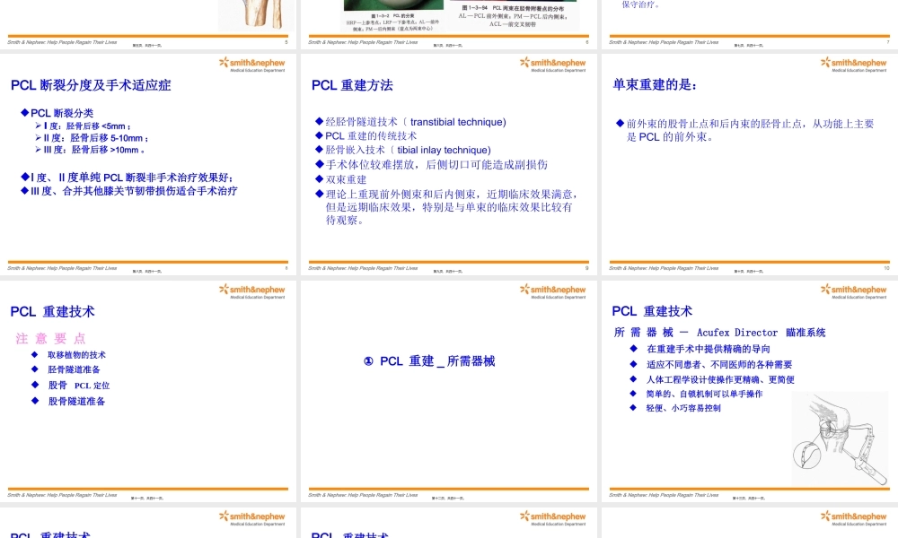 后交叉韧带重建术.pptx