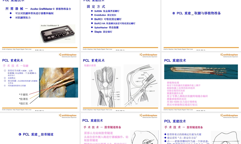 后交叉韧带重建术.pptx