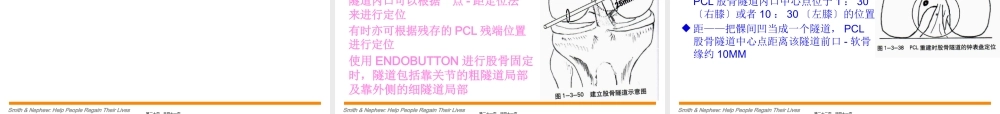 后交叉韧带重建术.pptx