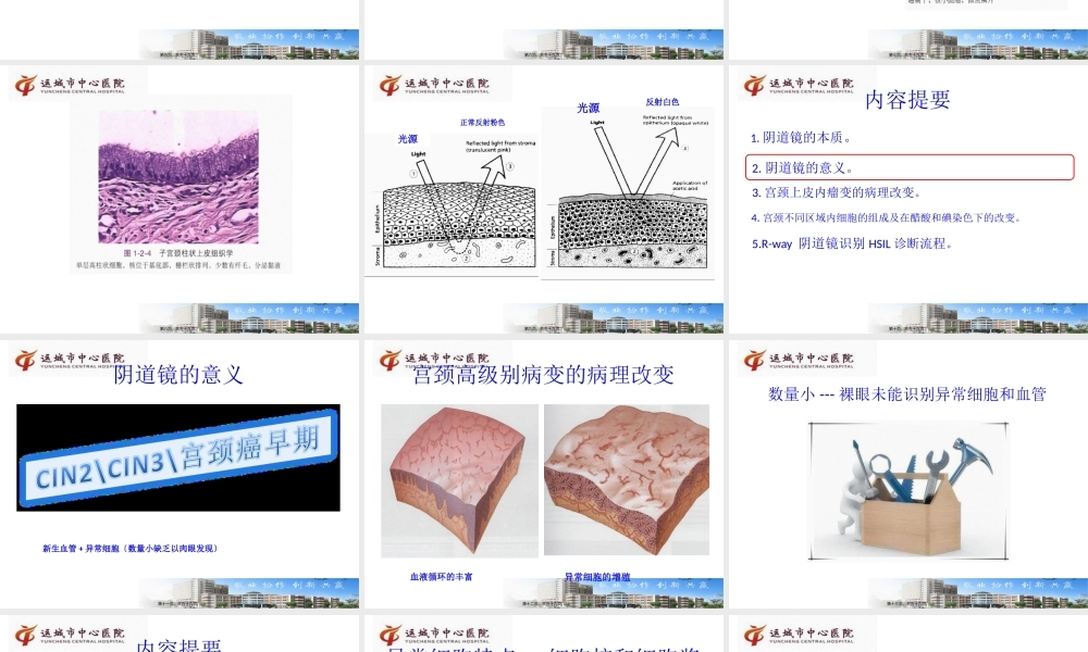 吕卫琴-阴道镜R-way诊治2015.8.29.pptx