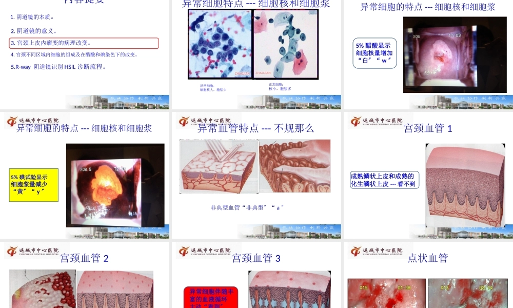 吕卫琴-阴道镜R-way诊治2015.8.29.pptx