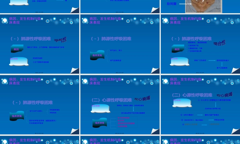 呼吸困难急诊处理.pptx