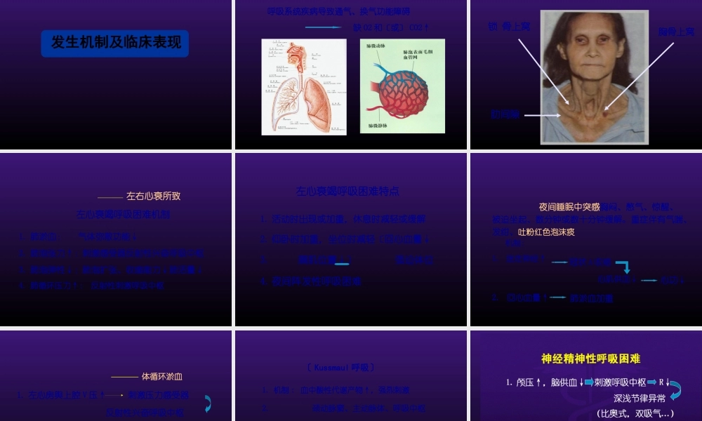 呼吸困难-胸痛.pptx